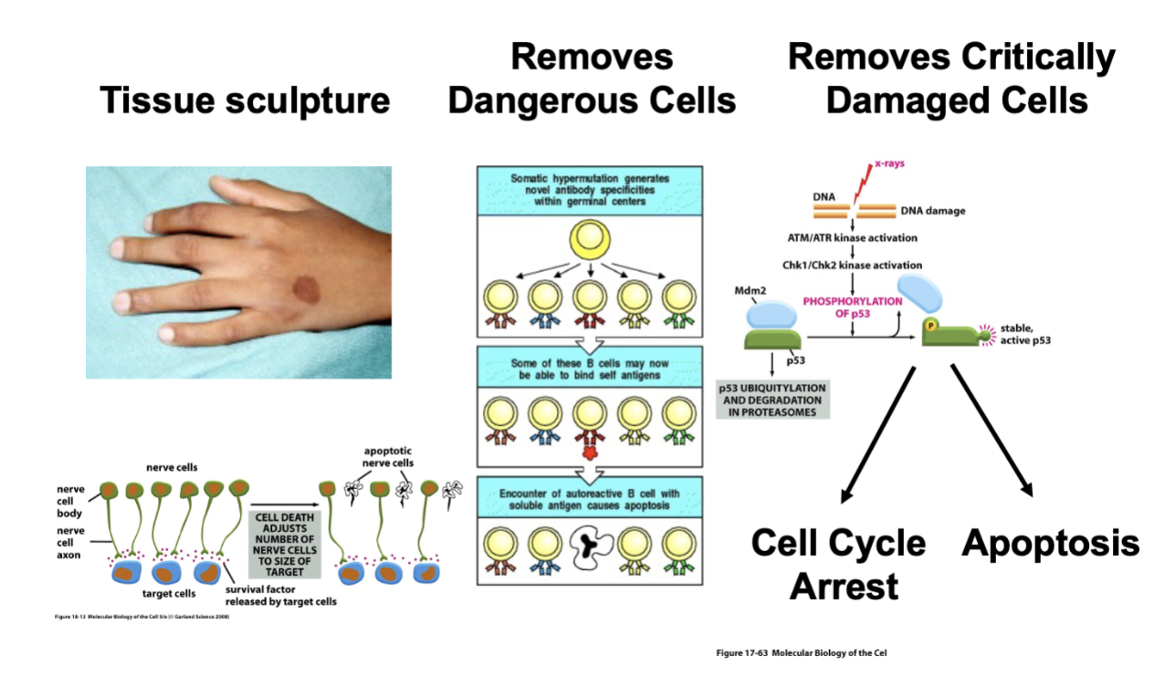 <ul><li><p>Essential process</p></li><li><p>Needed to sculpt tissue </p><ul><li><p>Cell death takes away tissue when there’s too much (extra webbing between the fingers)</p></li><li><p>As our brains develop in the late teenage years, early 20, it is a natural process for certain neurons in the brain to undergo death</p><ul><li><p>Removed from the cell population as a general principle — what you are doing is creating a more stable neural network, one with the proper connectivity </p></li><li><p>Normal developmental process</p></li></ul></li></ul></li><li><p>Cell death removes dangerous cells </p><ul><li><p>Immune systems recognize our own cells and attack our own cells to develop an auto-immune disease '</p></li><li><p>Early in development, cells in the immune system that attack other cells are removed through the process of cell death </p></li><li><p>It is important not just in developmental process but a mechanism for dealing with damage </p></li></ul></li><li><p>Cell death removes critically damaged cells </p><ul><li><p>Activation of kinases lead to the phosphorylation of transcription factor of p53</p></li><li><p>The activation of p53 leads to the expression of p21, which is an inhibitor of S phase cyclin CDK complexes </p></li><li><p>Cell with damaged DNA could not proceed into S phase </p></li><li><p>The other thing that p53 is important for is the activation of apoptosis (cell death removing damaged cells from a population)</p></li></ul></li></ul><p></p>
