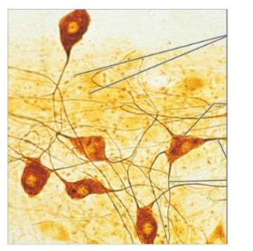 <p>Identify the tissue type based off the image below </p>