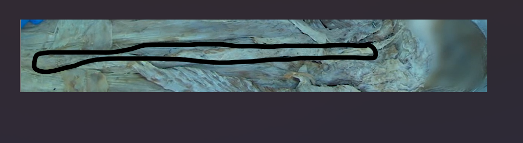 <p>A ligament that connects the spinous processes of each vertebrae and spans the entire vertebral column.</p>