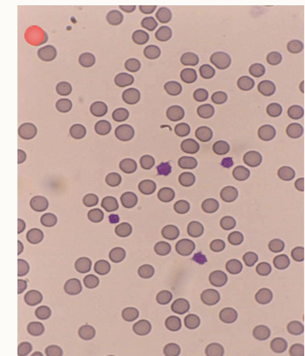 <p>Smaller erythrocytes</p><p>Mild anisocytosis (variation in size)</p><p>Scarce central pallor (less concave)</p>