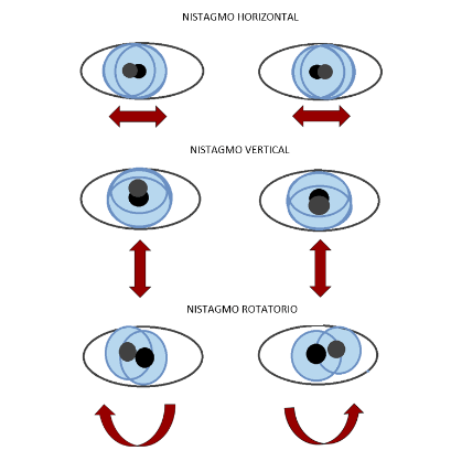 Sacudidas repetidas e involuntarias de los ojos, con una fase lenta en una dirección y otra rápida, en la dirección opuesta. 