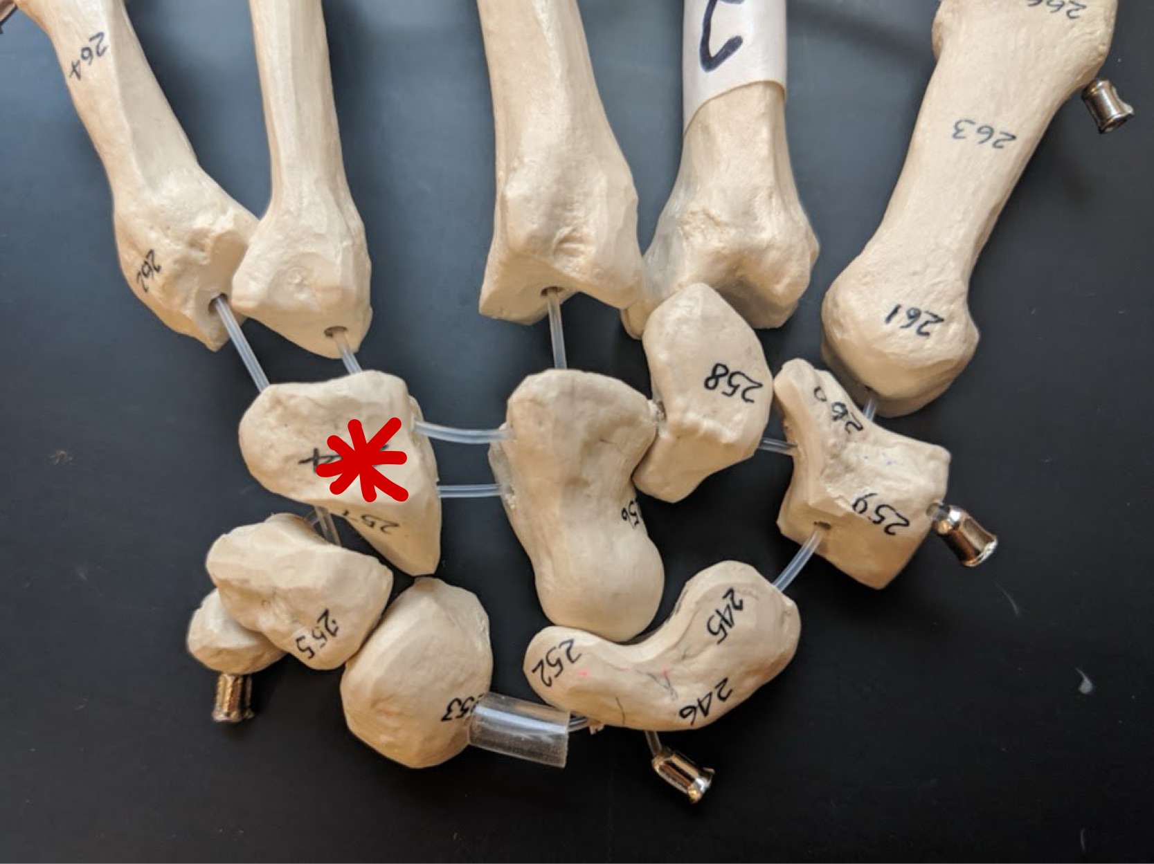 <p>Name this bone</p>