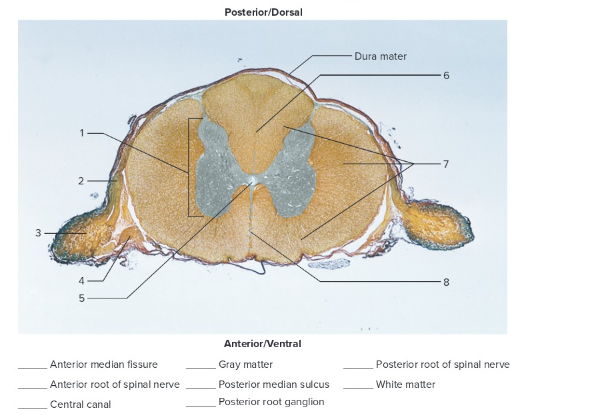 <p>Label the following: cross section with spinal nerve roots</p>