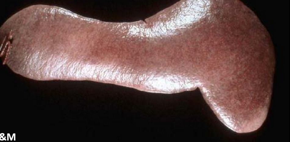 <p>What is this, and what causes it</p>