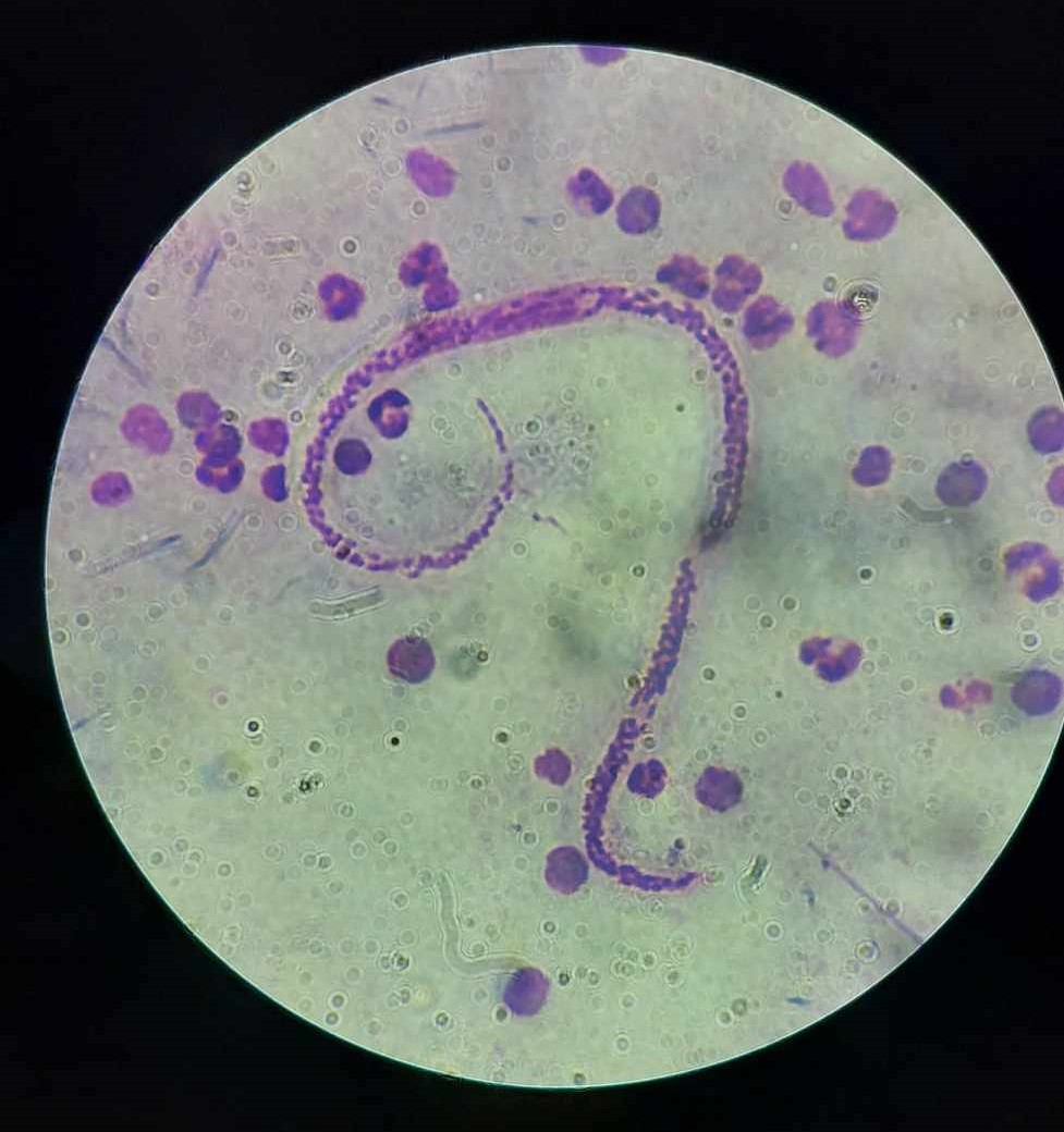 <p>This worm causes what disease?</p>