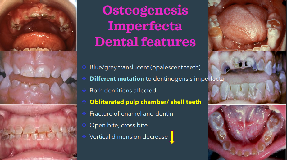 <p>dentinogenesis imperfecta; diff is they have diff mutations </p>