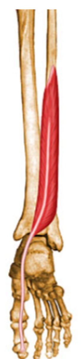 <p>what is this muscle?</p>