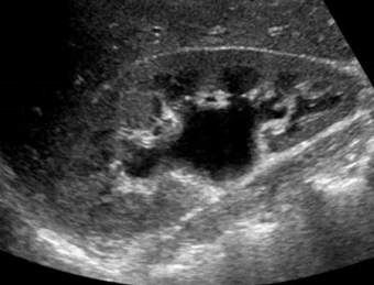 <ul><li><p>requires background info to diagnose</p></li></ul><p></p>