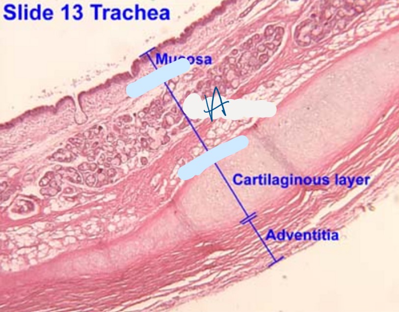 <p>Which layer of the trachea is indicated by A</p>