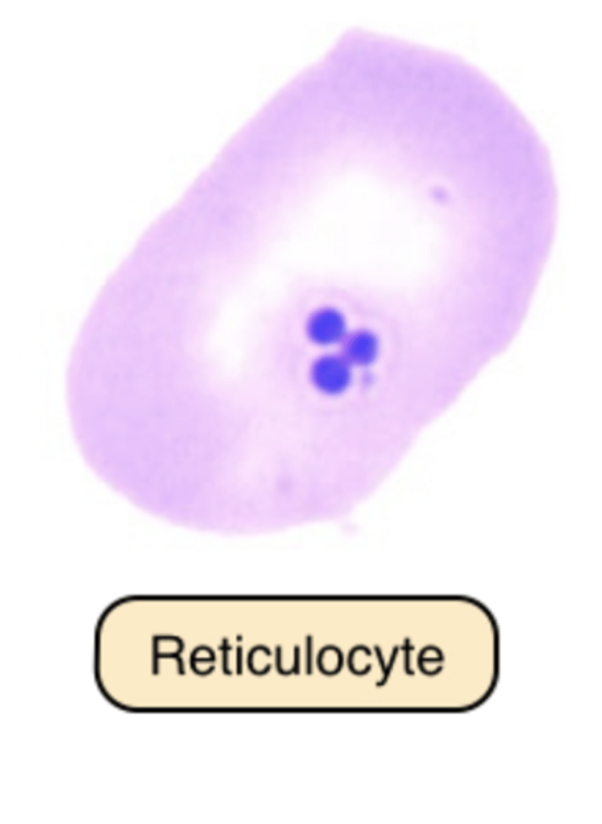 <p>&gt; young RBCs that contain ribonucleic acid (RNA) -- when RNA is visualized using vital stains.</p>