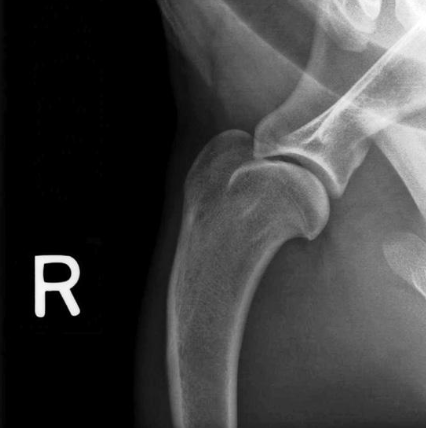 <p>what radiograph view of the shoulder joint is shown?</p>