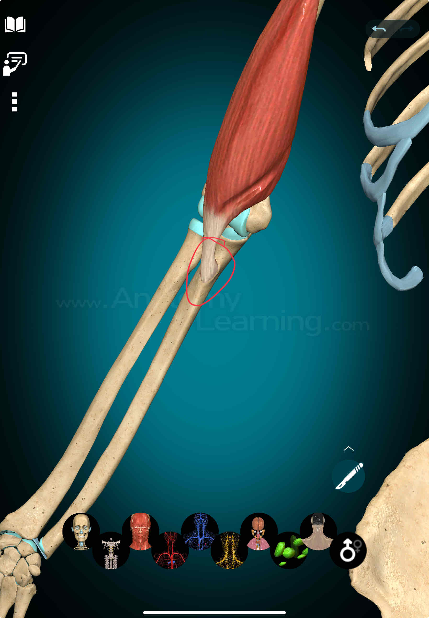 <p>Brachialis Insertion</p>
