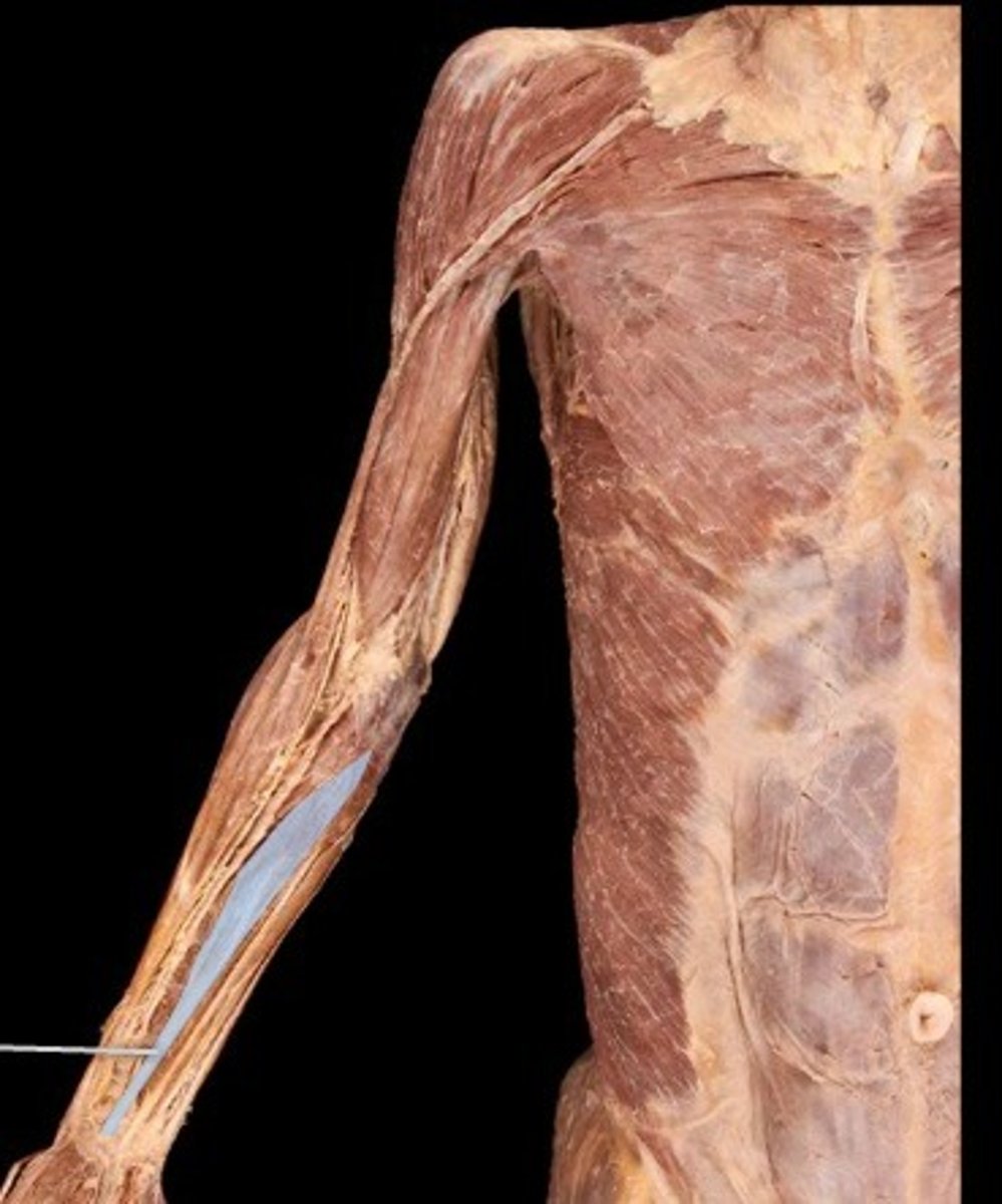 <p>What muscle is this?</p>