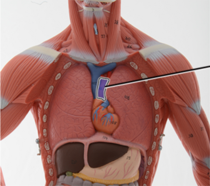 <p><span style="color: rgb(0, 0, 0);">Name this part of the aorta.</span></p>