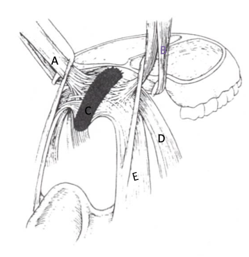 <p>label d, e</p>