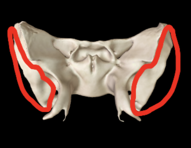 <p>What part of the sphenoid is this?</p>