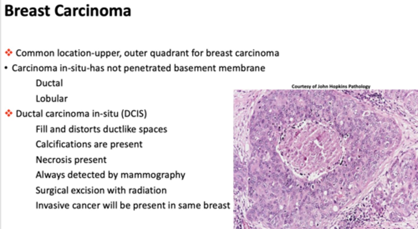 <p>ductal carcinoma in situ (DCIS)</p>