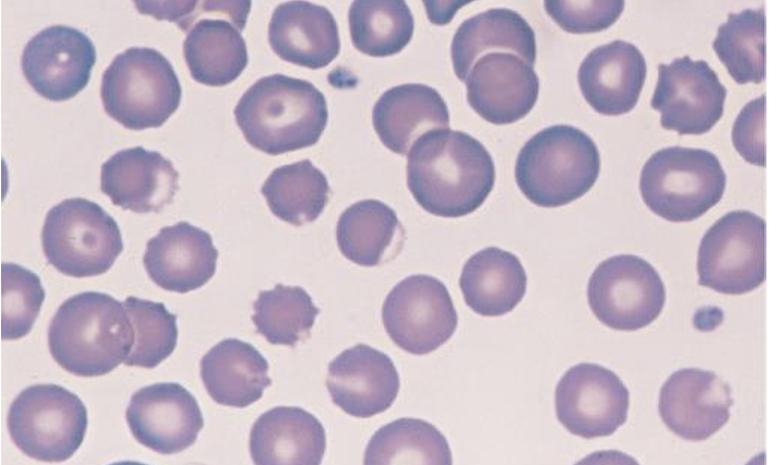 <p>What abnormality can you see in this image?</p>