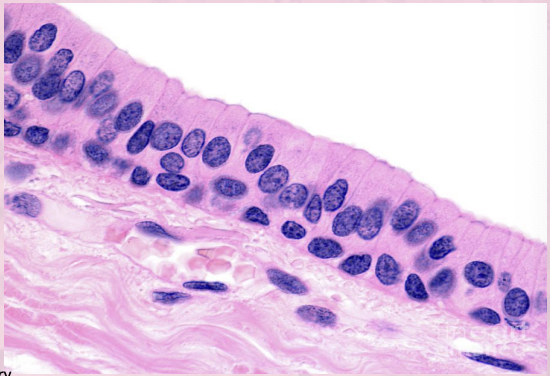<p>multiple layered stacked cells found in areas needing protection and secretion</p>
