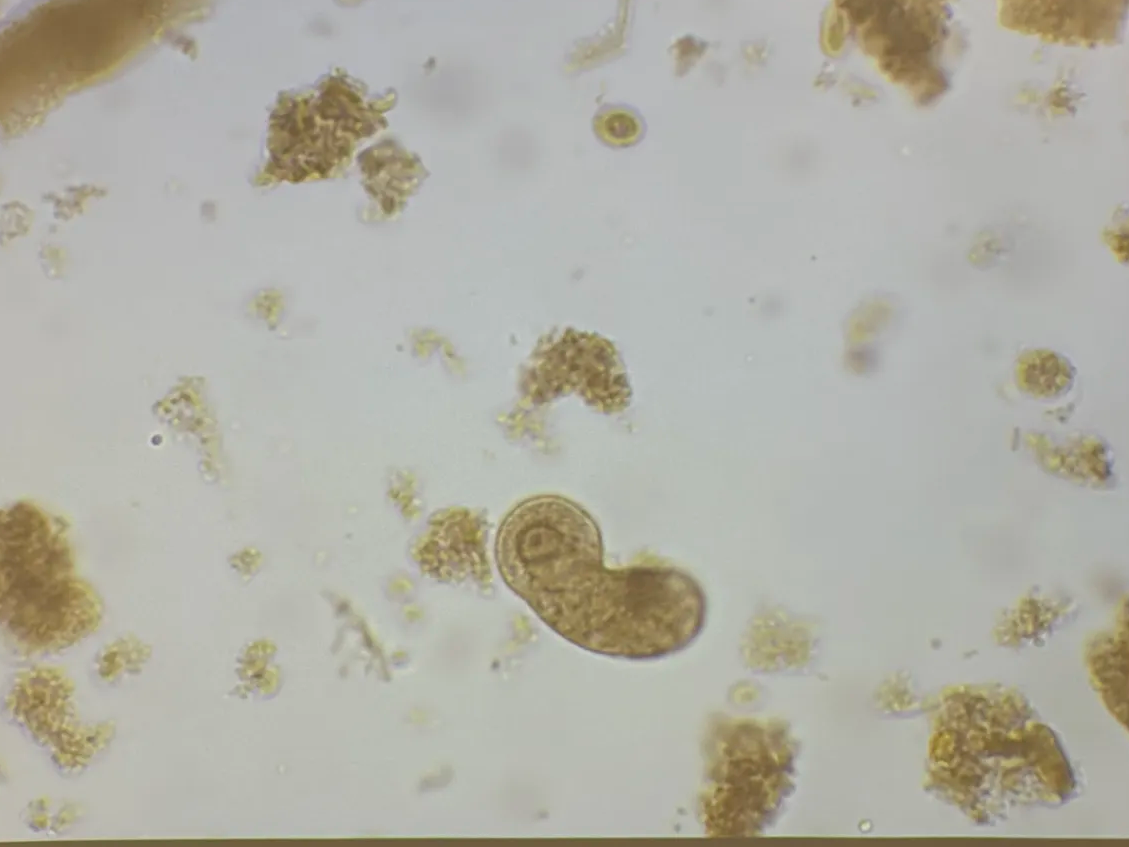 <p>in human with GI problems</p>