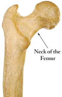 <p>Femur: Bone Location</p>