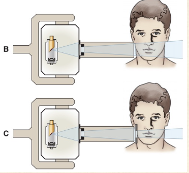 <ul><li><p>Device that limits the x-ray field to dimensions large enough to cover the region of interest</p></li><li><p>Prevents exposing the patient to unnecessary primary radiation</p></li><li><p>Reduces the amount of scatter radiation to image, patient and operator</p></li><li><p><strong>Decreases radiation dose by 5x</strong> as compared to a circular one</p></li><li><p>Radiation dose to the thyroid was less using rectangular collimation alone vs. using both a round cone and thyroid collar shield</p></li></ul><p></p>