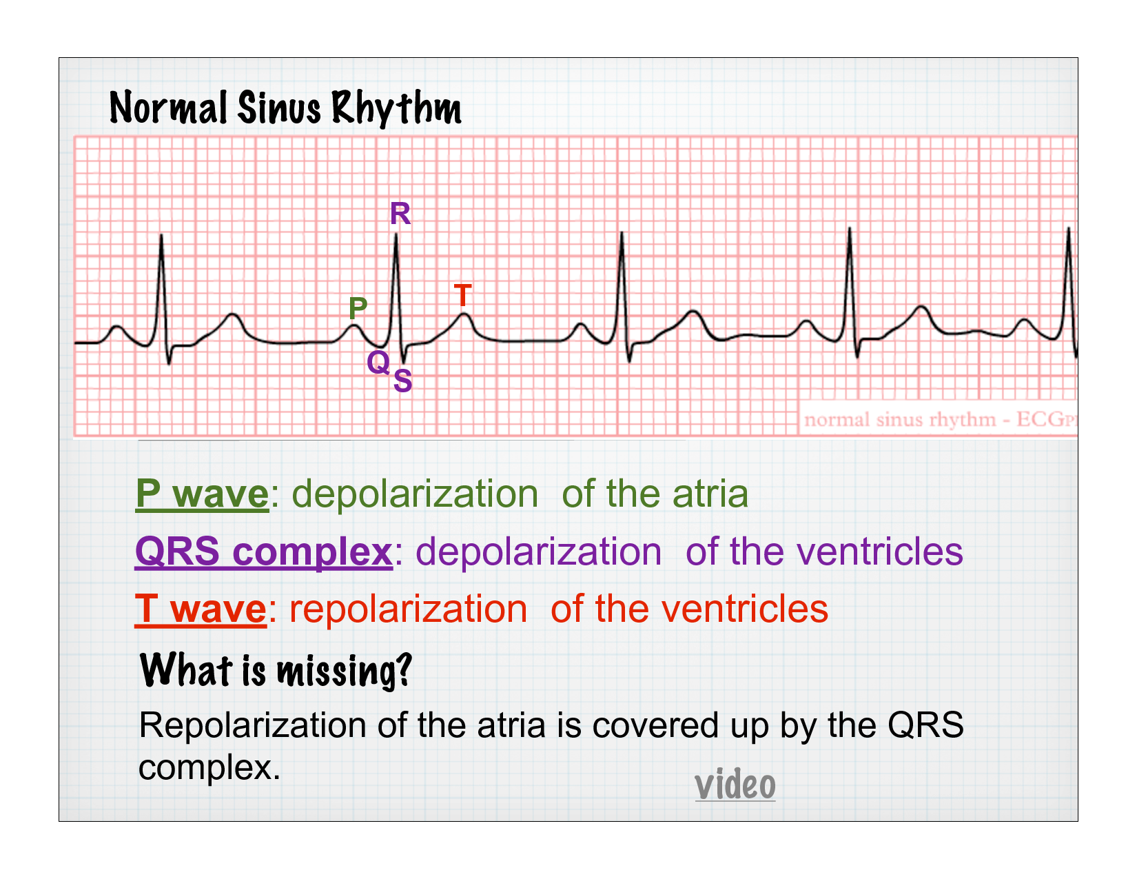 <p>QRS complex</p>