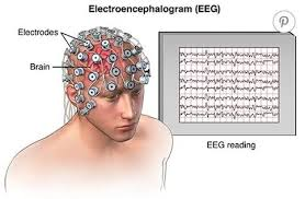 <ul><li><p><span><span>continuously measure electrical activity of brain using multiple electrodes attached to skull; rules out seizure disorders, etc.</span></span></p></li><li><p><span><span>records brain activity, most helpful in assessing seizure activity.</span></span></p></li></ul><p></p>