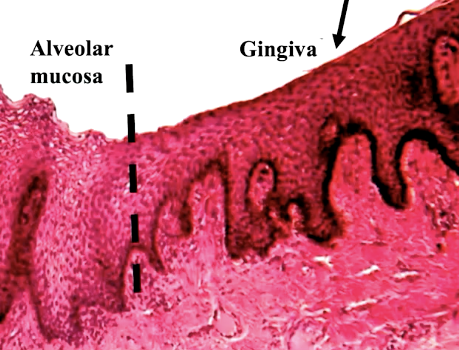 <p>alveolar mucosa has SSNKE epithelial cells while gingiva has SSKE/SSPKE and a layer of connective tissue (harder to see through the keratonized layer into the blood vessels)</p>