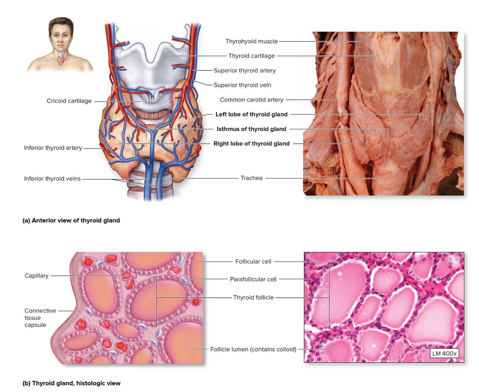 <p>Thyroid gland</p>