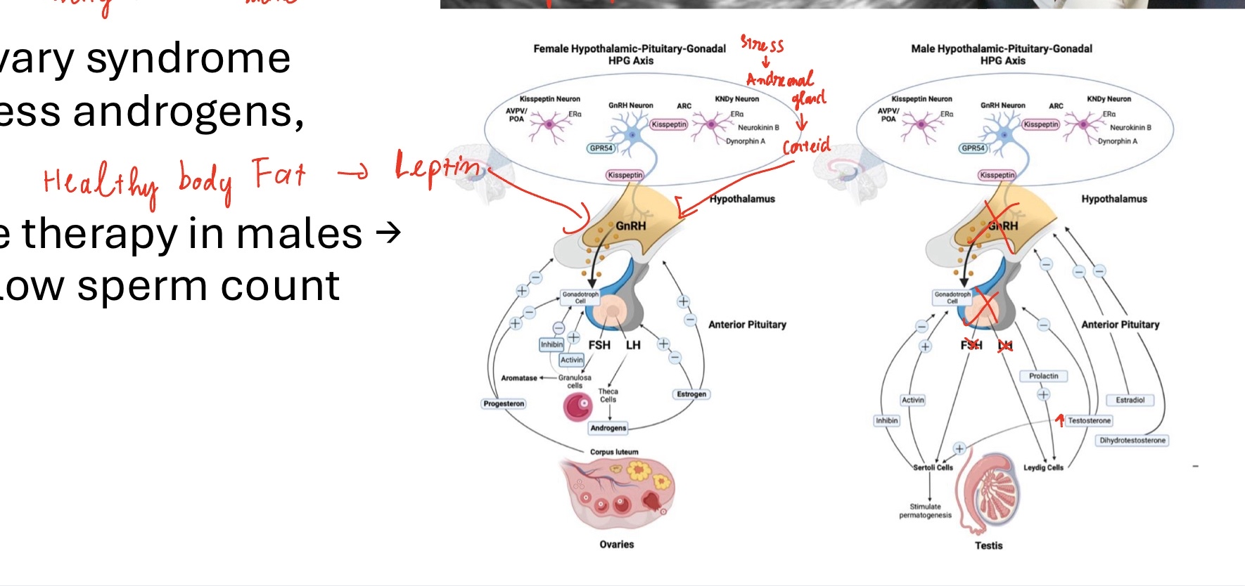 <p><span style="color: rgb(0, 0, 0);"><span>• Low body fat / stress → ↓ GnRH → amenorrhea → ability to menstructe</span></span><span style="color: rgb(0, 0, 0);"><br></span><span style="color: rgb(0, 0, 0);"><span>• Polycystic ovary syndrome (PCOS): excess androgens, anovulation: </span></span><span style="color: rgb(0, 0, 0);"><br></span><span style="color: rgb(0, 0, 0);"><span>• Testosterone therapy in males → ↓ FSH/LH → low sperm count</span></span></p>