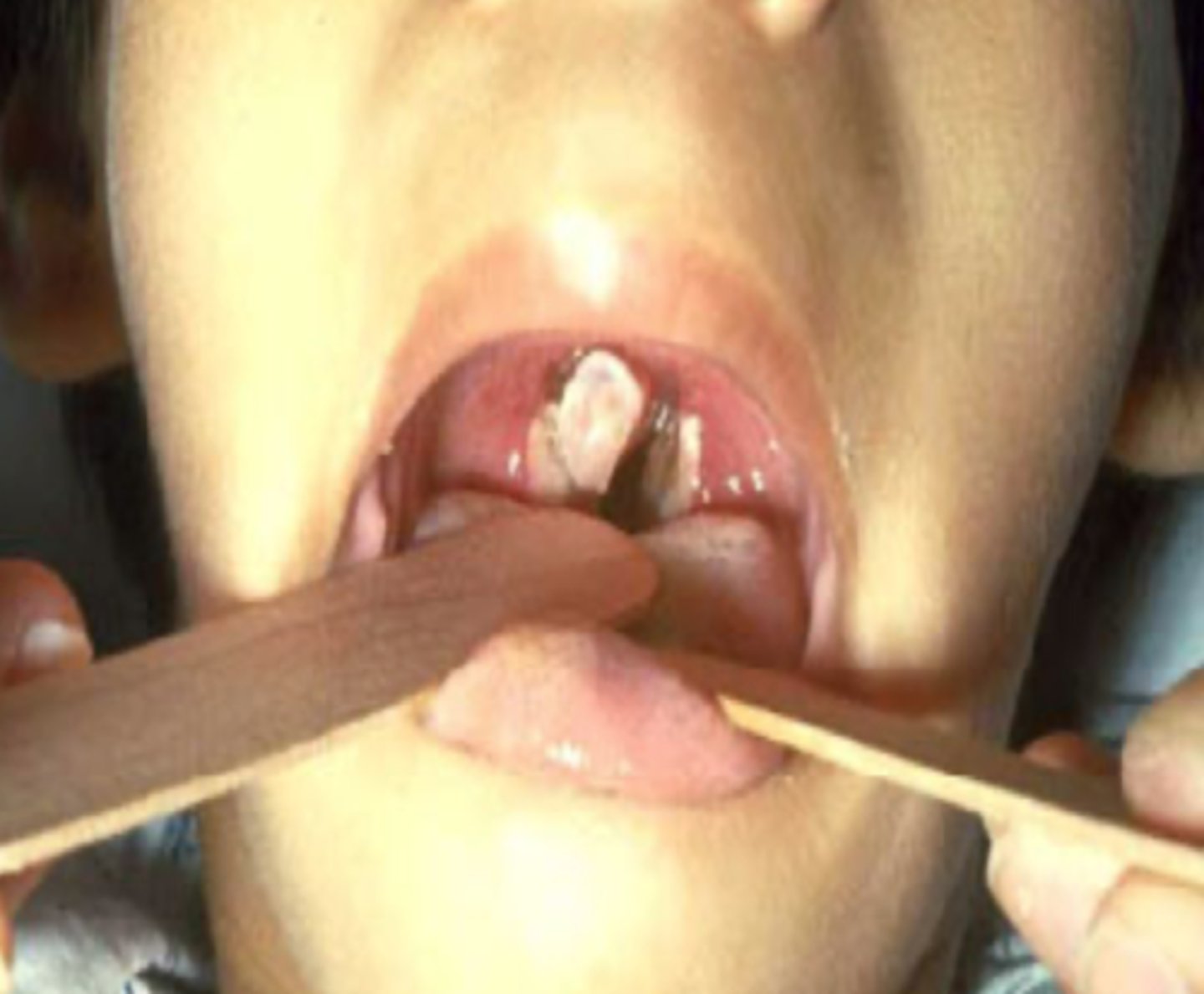 <p>What is the diagnosis?</p>