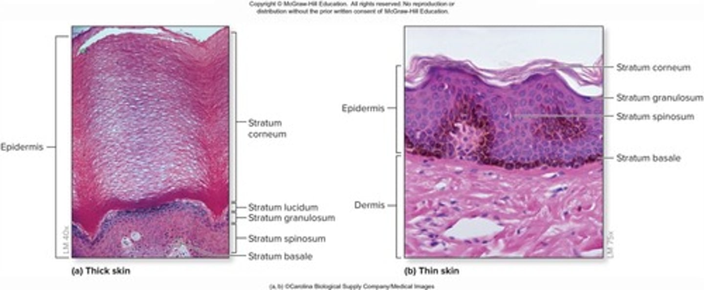 <p>Contains all five layers of epidermal strata; found in palms of hands and soles of feet; has sweat glands but no hair follicles or sebaceous glands.</p>
