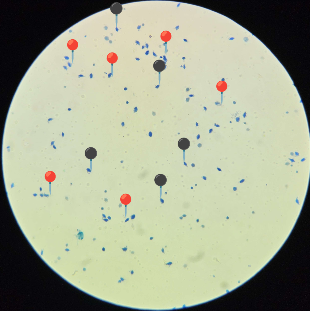 <p><strong><em>Trichomonas vaginalis</em></strong></p><p>(Trofozoit)</p><p></p><p></p><p><strong>Organelle:</strong></p><p></p><ul><li><p><span data-name="red_circle" data-type="emoji">🔴</span><span data-name="yellow_circle" data-type="emoji">🟡</span><span data-name="green_circle" data-type="emoji">🟢</span><span data-name="blue_circle" data-type="emoji">🔵</span><span data-name="purple_circle" data-type="emoji">🟣</span><span data-name="black_circle" data-type="emoji">⚫</span><span>️</span><span data-name="white_circle" data-type="emoji">⚪</span><span data-name="brown_circle" data-type="emoji">🟤</span></p></li></ul><p></p><ul><li><p><span data-name="red_circle" data-type="emoji">🔴</span><span data-name="yellow_circle" data-type="emoji">🟡</span><span data-name="green_circle" data-type="emoji">🟢</span><span data-name="blue_circle" data-type="emoji">🔵</span><span data-name="purple_circle" data-type="emoji">🟣</span><span data-name="black_circle" data-type="emoji">⚫</span><span>️</span><span data-name="white_circle" data-type="emoji">⚪</span><span data-name="brown_circle" data-type="emoji">🟤</span></p></li></ul><p></p><p></p><p><strong>Parazytoza:</strong> <em>Rzęsistkowica</em></p>
