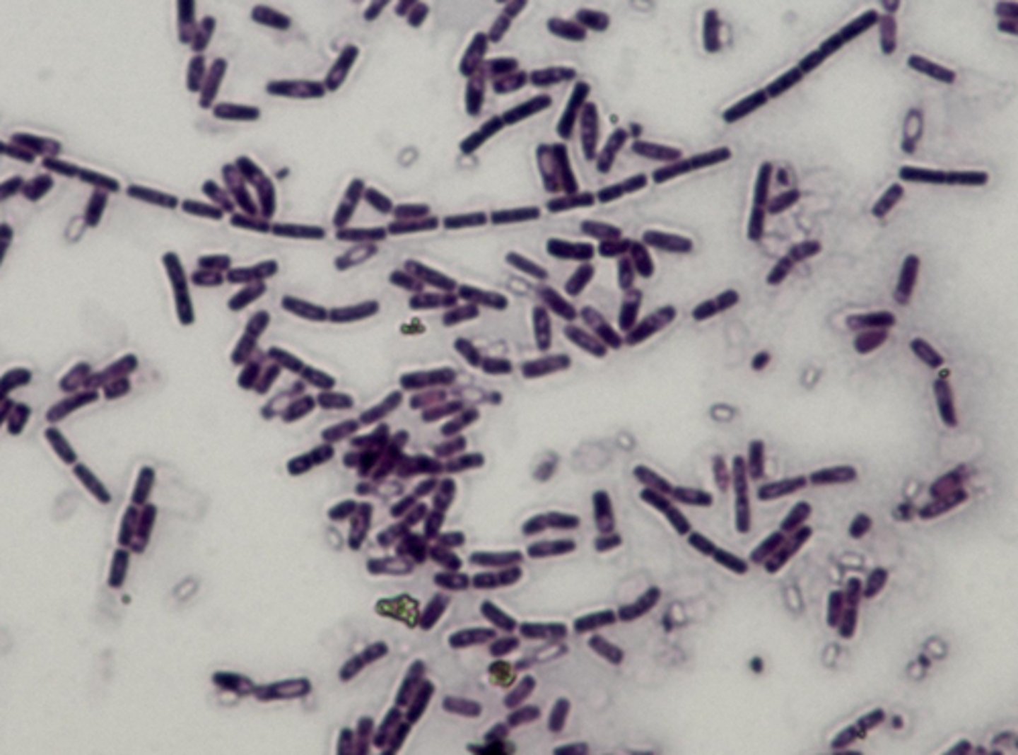<p>Identify Pathogen causing Diarrhea:</p><p>Gram positive rod --&gt; Ingested enterotoxin</p><p>-Hx: Undercooked/Reheated Rice ("Reheated rice syndrome")</p><p>&gt; Heat-resistant spores survive cooking</p><p>&gt; Cooked rice at room temperature</p><p>-Path/Sx/PE:</p><p>&gt; Nausea/Vomiting (Emetic):</p><p>&gt;&gt; D/t direct ingestion of Cereulide toxin (heat stable)</p><p>&gt;&gt; Abdominal Cramps + N/V</p><p>&gt;&gt; Often from Rice disrhes</p><p>&gt; Diarrheal Type:</p><p>&gt;&gt; Abdominal Cramps + WATERY Diarrhea</p><p>&gt;&gt; 8-16 hrs after ingestion</p><p>&gt;&gt; D/t several enterotoxins (heat labile)</p><p>&gt;&gt; Cooking food reduces risk</p><p>&gt;&gt; From meats, veggies, sauces</p><p>-Dx:</p><p>&gt; Stool and/or Food Culture</p><p>&gt; Toxin Assay</p>