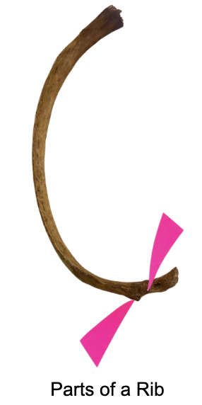 <p>The "non-articulating part" of the tubercle of a rib is for what part of the transverse process:</p><p>A. Joint</p><p>B. Ligament</p><p>C. Tendon</p><p>D. Artery-&amp;-Vein</p>