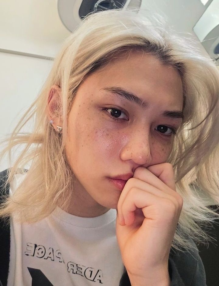 <p>freckles </p>