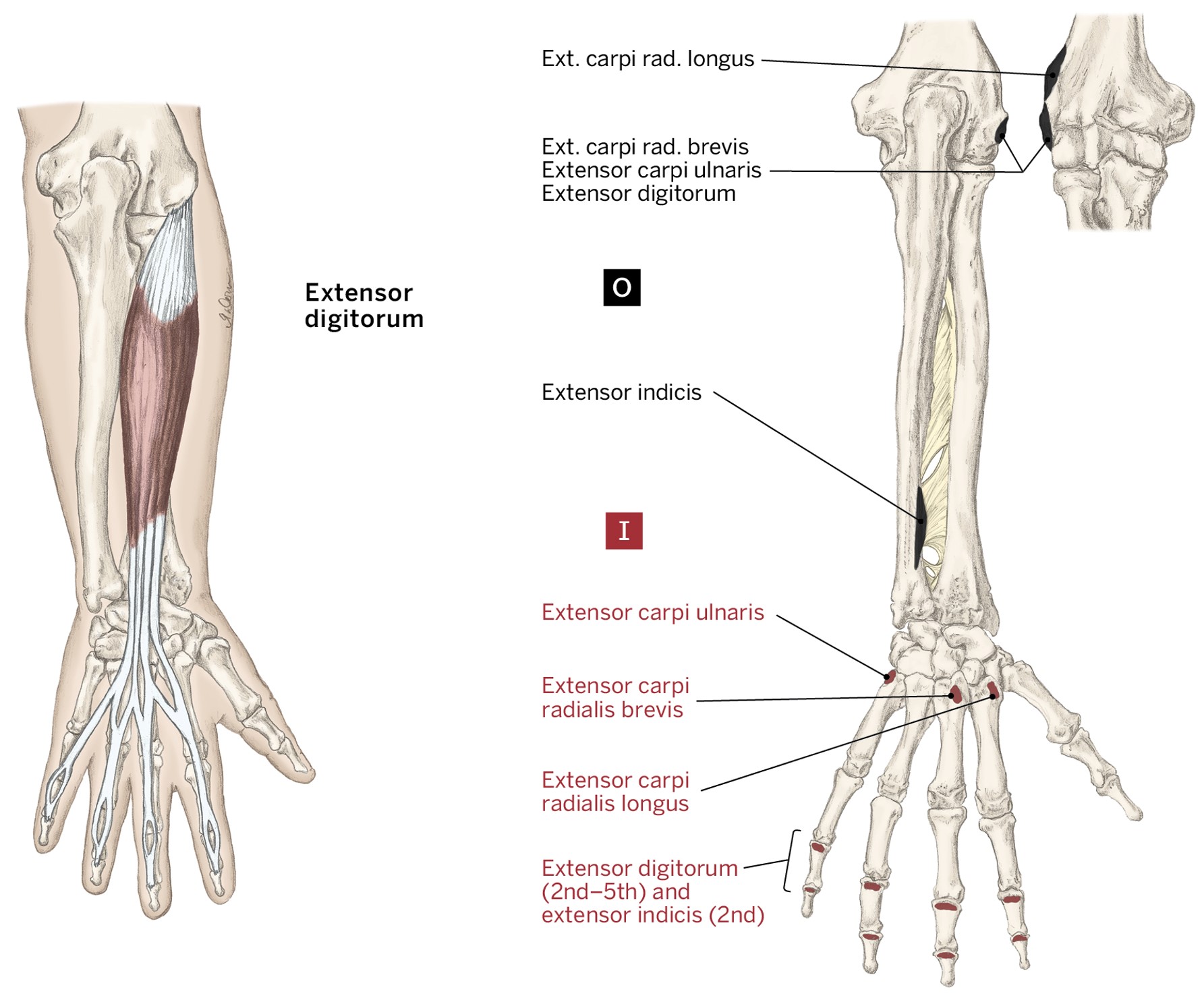 <p>O- Lateral Epicondyle of the humerus</p><p>I- (Posterior) 2nd to 5th middle &amp; distal phalanges</p><p>A- 2nd to 5th metacarpophalangeal &amp; interphalangeal joint extension</p>