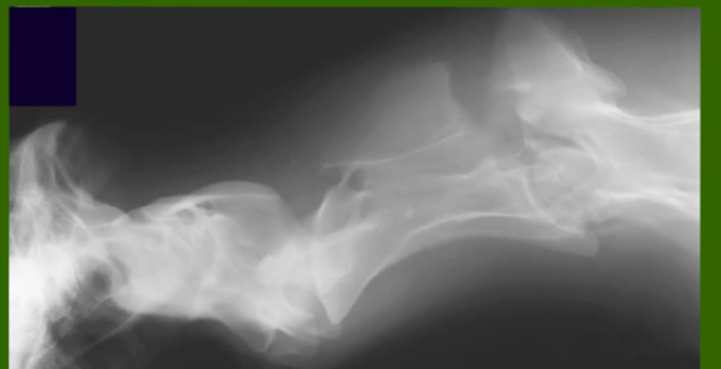 <p>Where is the fracture?</p>
