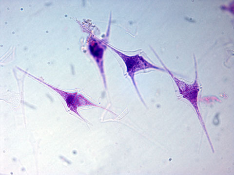 <p><strong>Phylum Dinoflagellata</strong></p><p></p>