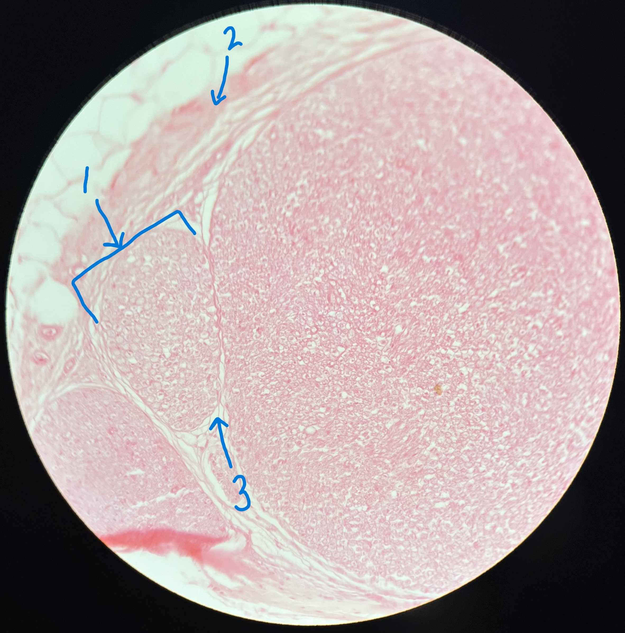 <p>What is #2 pointing to?</p>