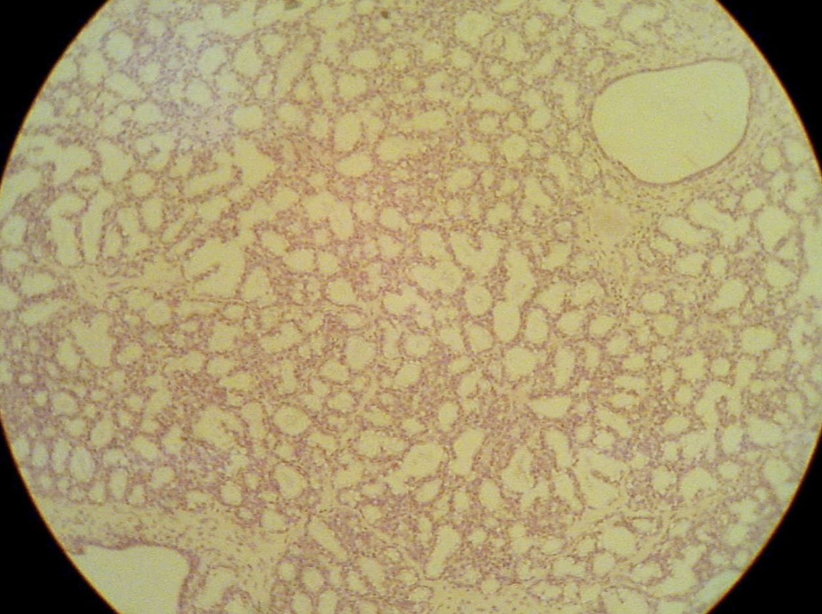 <p>What phase is this mammary tissue undergoing?</p>