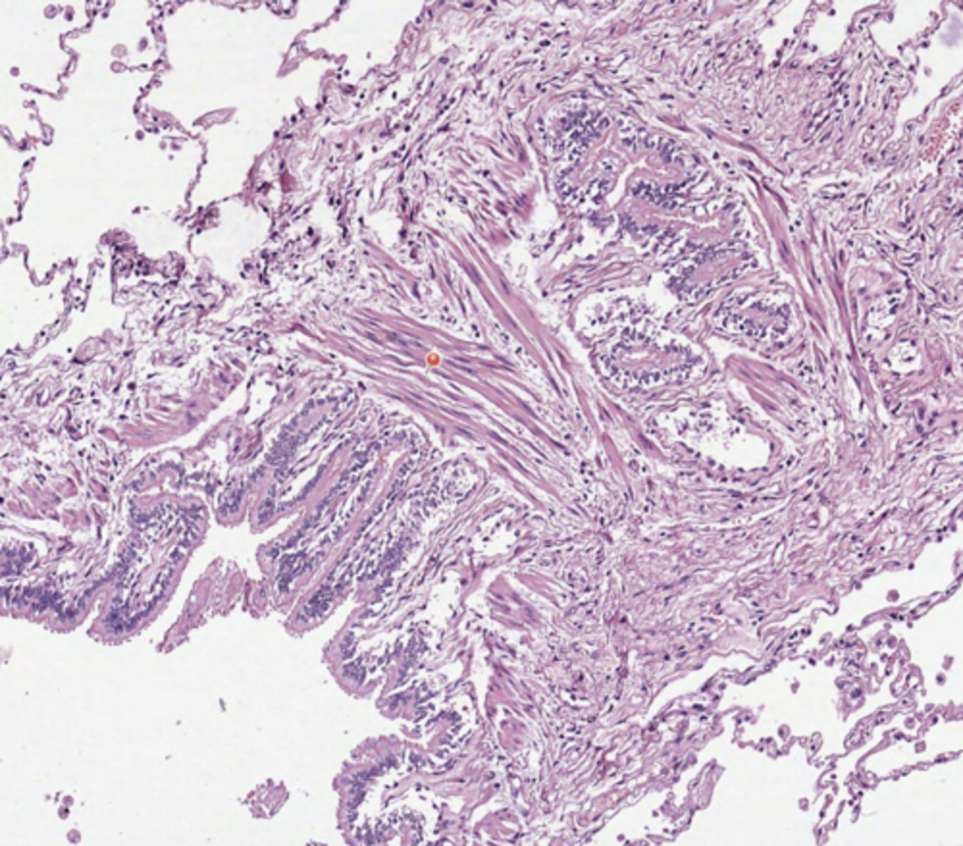 <p>Lung</p>