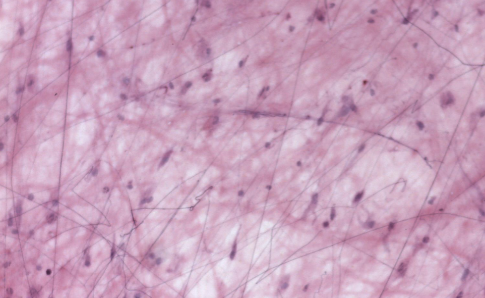 <ol><li><p><strong>Name the tissue type</strong></p></li><li><p><strong>Know where it is found in the body</strong></p></li><li><p><strong>Know its structure</strong></p></li><li><p><strong>What is the white background?</strong></p></li></ol><p></p>