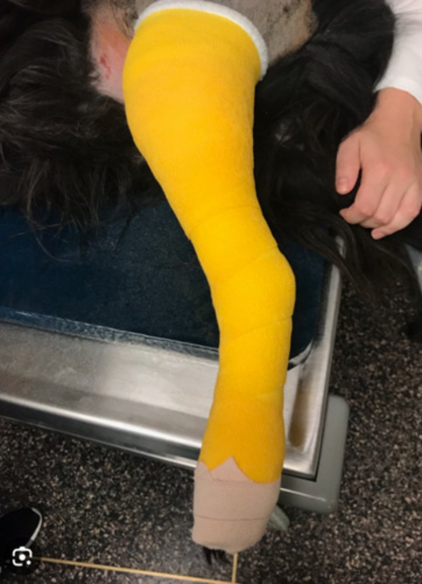 <p>What bandage is this?</p>