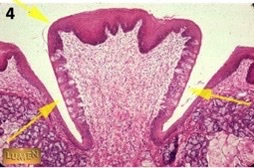 <p>what type of papillae?</p>