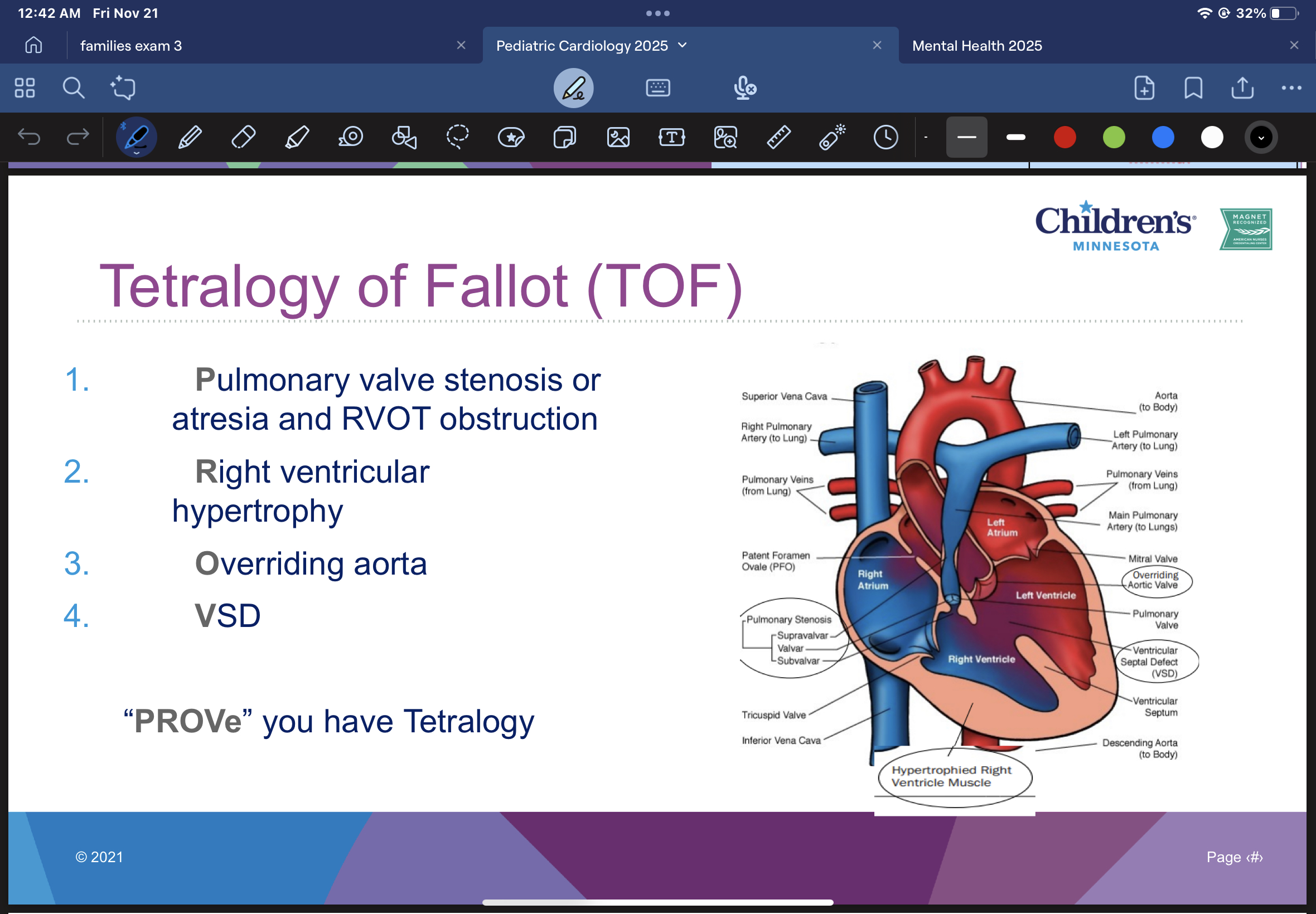 <ol><li><p><strong>p</strong>ulmonary valve stenosis or atresia and RVOT obstruction</p></li><li><p><strong>r</strong>ight ventricular hypertrophy</p></li><li><p><strong>o</strong>verriding aorta</p></li><li><p><strong>V</strong>SD</p></li></ol><p></p><p><strong>“PROVe” you have tetralogy</strong></p><p></p>