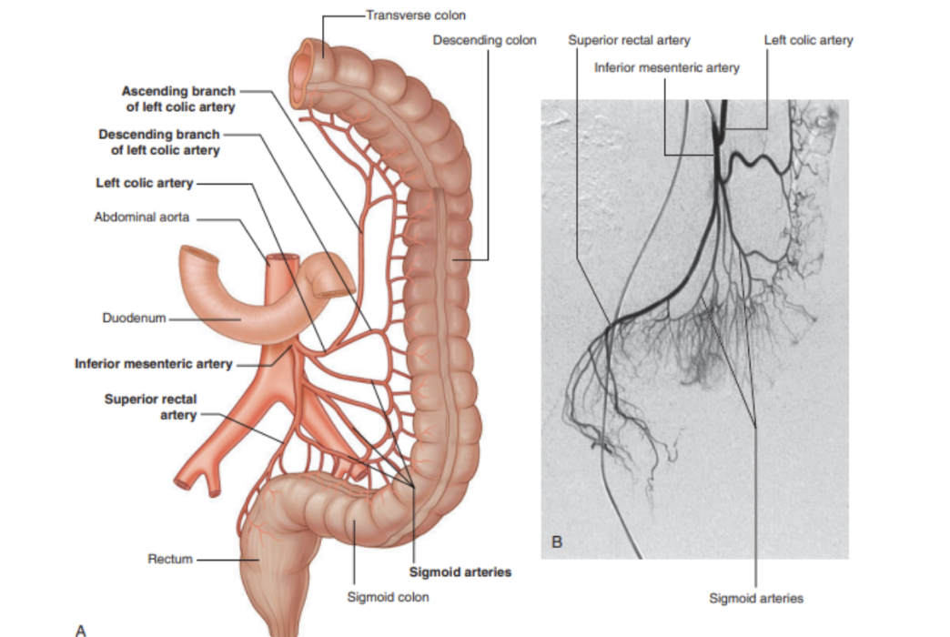 <p>Anterior branch of abdominal aorta — supplying hndgut </p><ul><li><p>Smallest of 3 anterior branches of abdominal aorta, arising anteriorly to L3</p></li><li><p>Initially descends anteriorly to aorta then passes left as it continues inferiorly</p></li><li><p>Branches into —</p><ul><li><p>Left colic artery</p></li><li><p>Several sigmoid arteries</p></li><li><p>Superior rectal artery</p></li></ul></li></ul>
