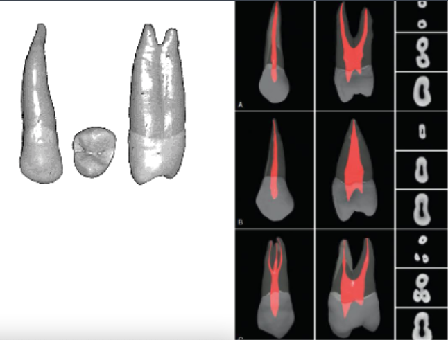<p>kidney, figure 8, hourglass</p>