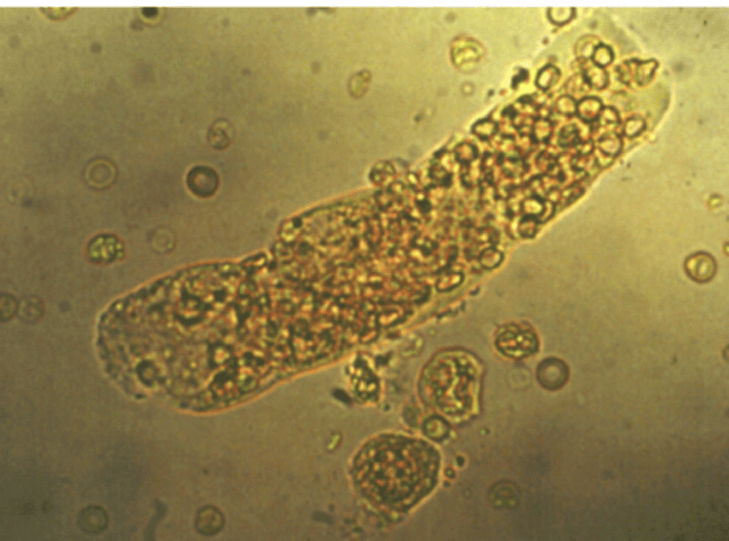 <p>contain intact and disintegrated or crenated red blood cells. When many cells are enclosed within the matrix of the cast, a red blood cell cast appears yellow or reddish-brown. The presence of ______ casts in the urine indicates bleeding into the nephron.</p>